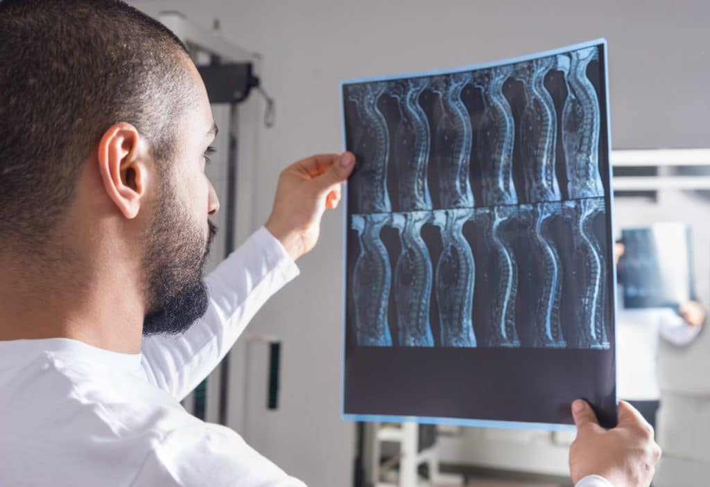 Doctor Analyzing Spine X-ray | Motor Vehicle Accident Lawyers in New York | Gash & Associates, P.C