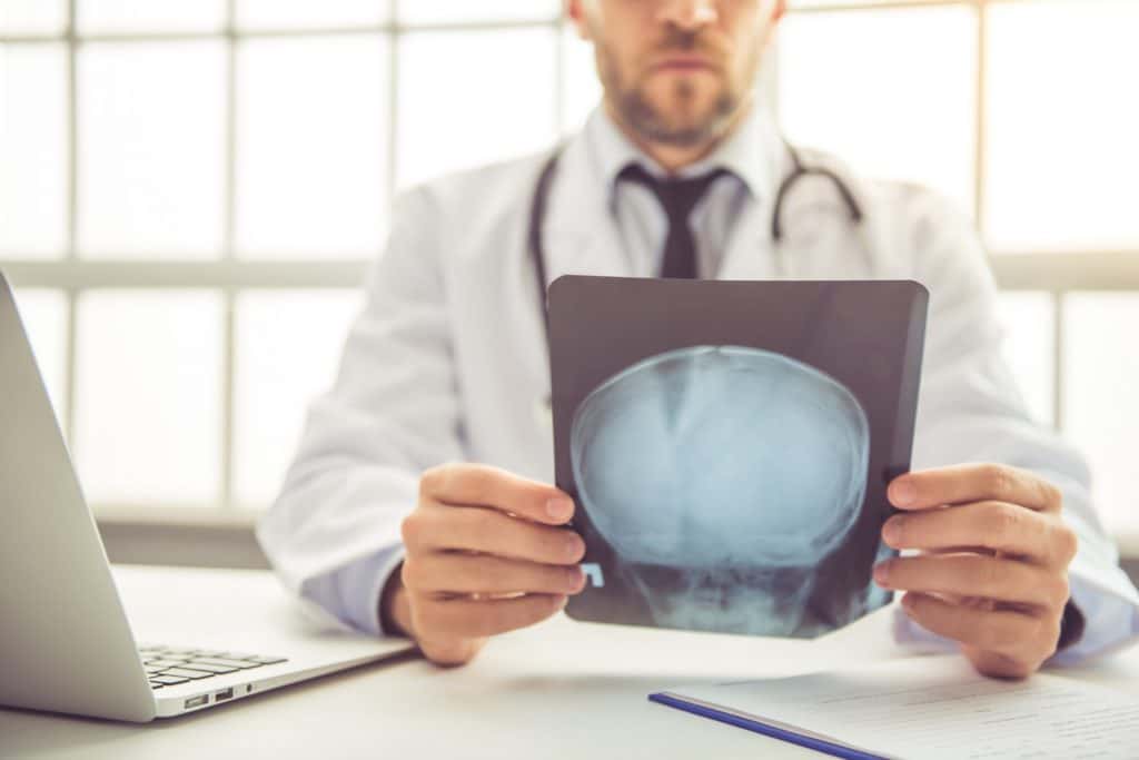 Doctor Studying Brain Xray | Workplace Injury Lawyers in New York City | Gash & Associates, P.C.