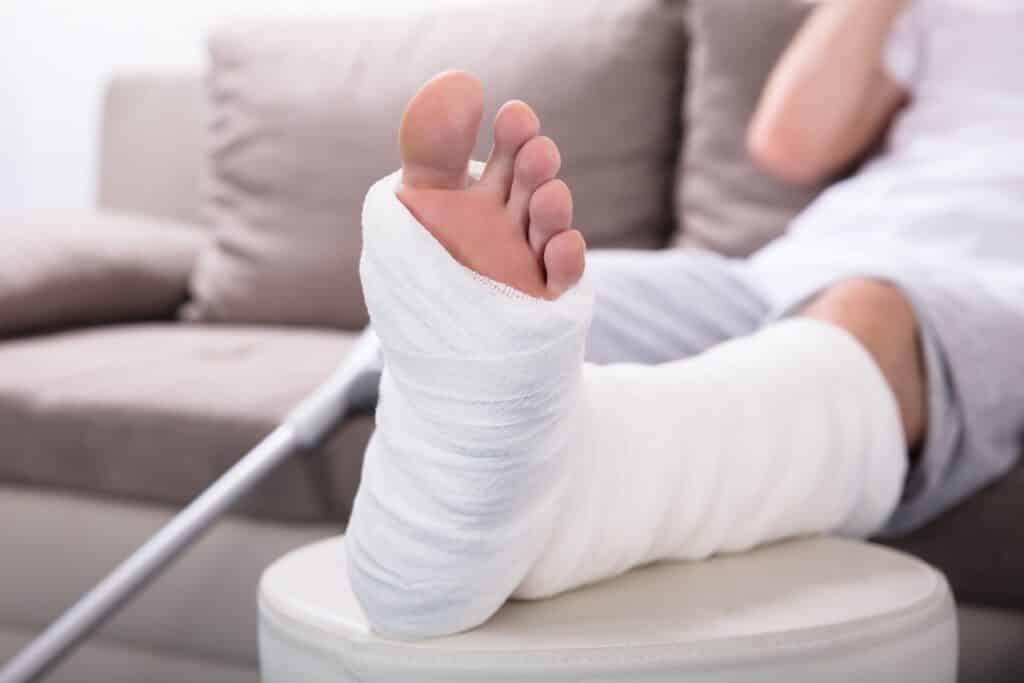 Injured Man's Plastered Leg | Slip and Fall Accident Attorneys in NYC | Gash & Associates, P.C.